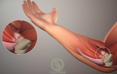 Hội chứng cổ vai cánh tay có thể gây nguy hại nghiêm trọng đến khả năng vận động, cũng như đời sống và sức khỏe của người bệnh nếu không được điều trị. Trường hợp bệnh chuyển biến nặng có thể gây ra nhiều biến chứng nguy hiểm...