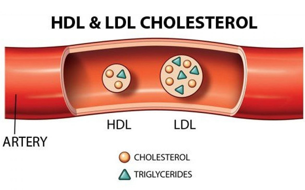 Cách Để Tăng HDL Cholesterol Hiệu Quả ?