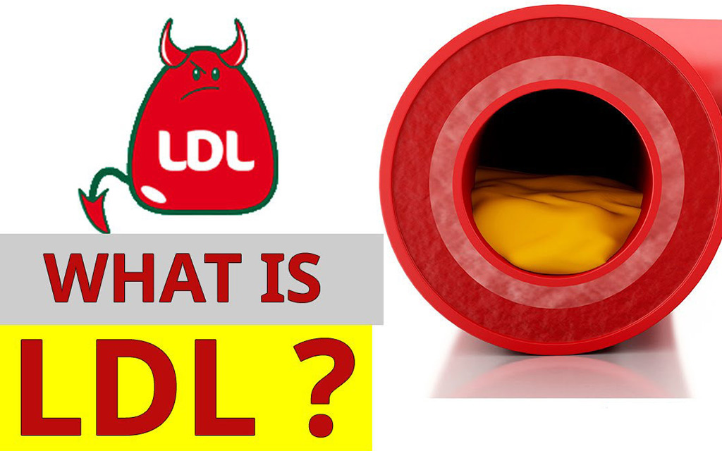 Chỉ Số LDL Cholesterol Là Gì ?