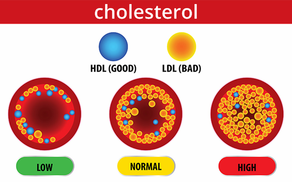 Chỉ số LDL Cholesterol Thấp Có Nguy Hiểm Không ?